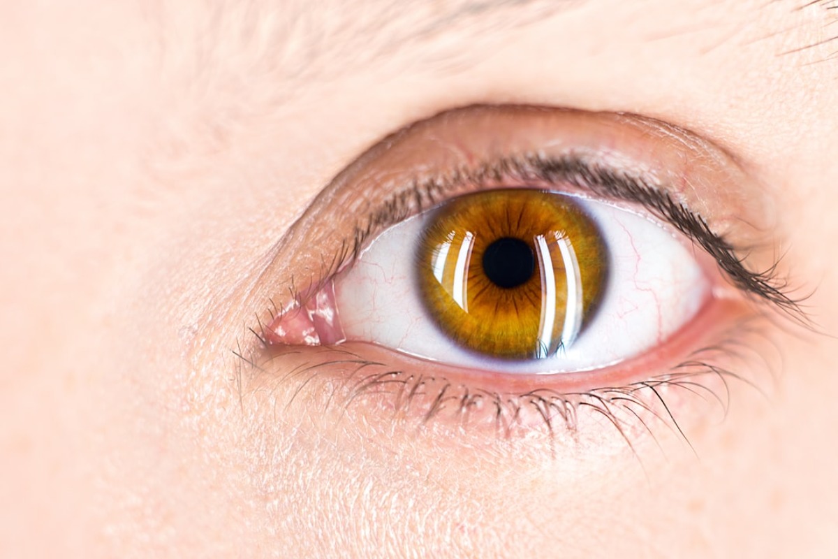Titelbild zu „Körperliche Anstrengung nach dem Augenlasern – Das sollte beachtet werden“